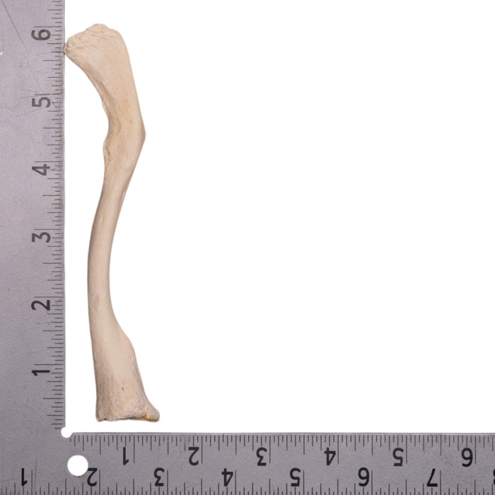 Real Human Clavicle - Pathology
