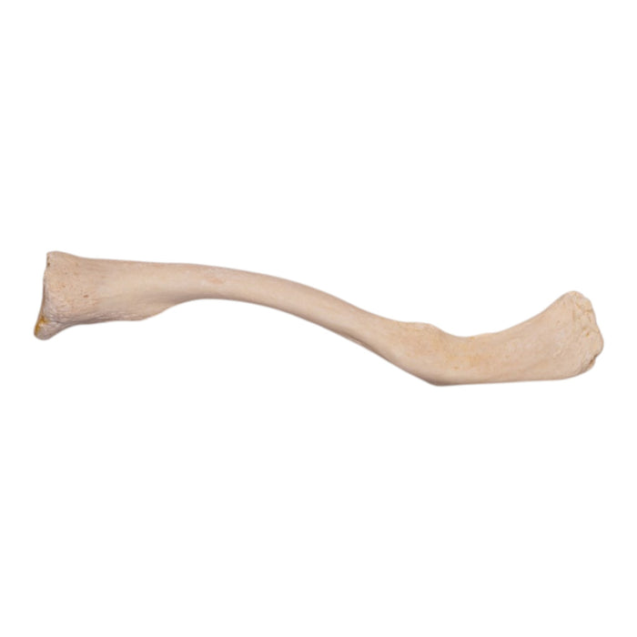 Real Human Clavicle - Pathology