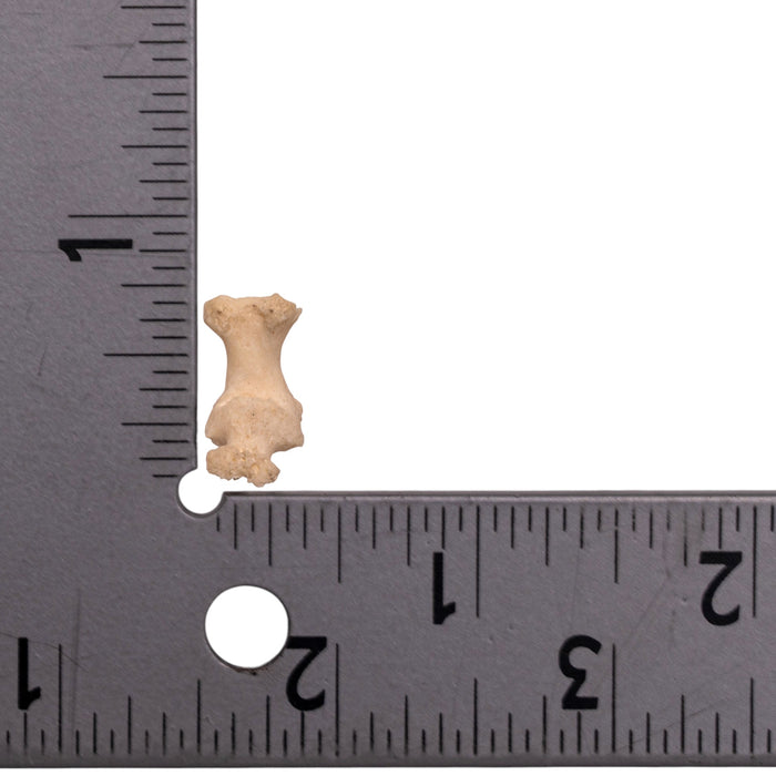 Real Human Phalange - Pathology