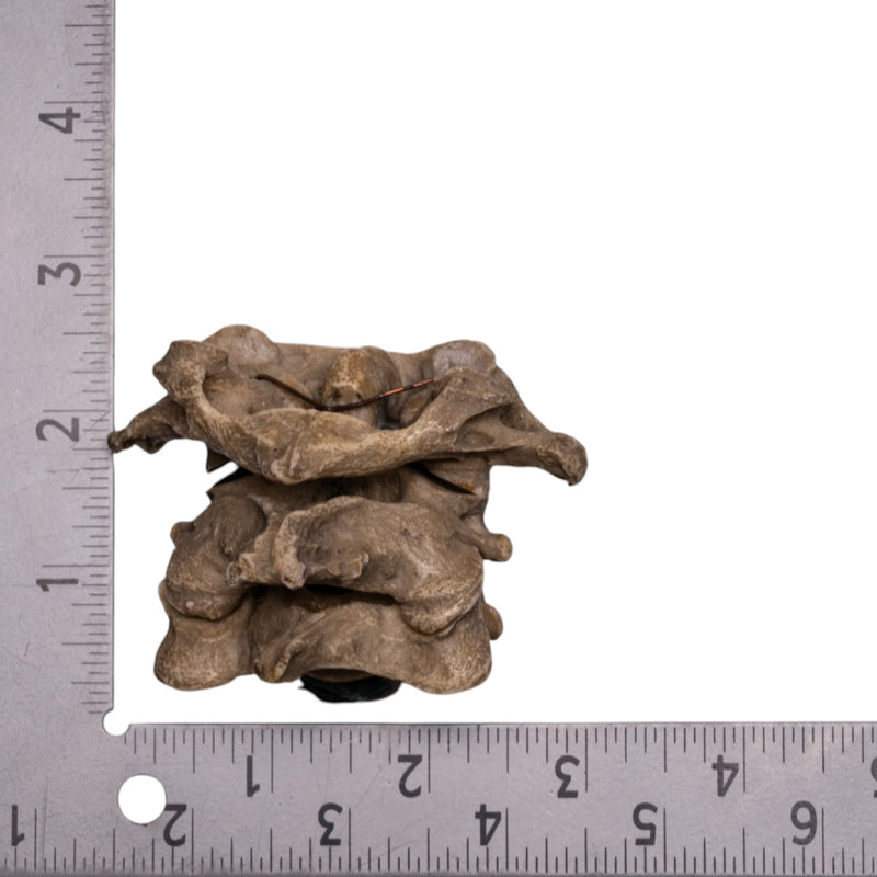 Real Human Vertebrae Set