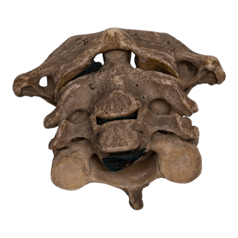 Real Human Vertebrae Set