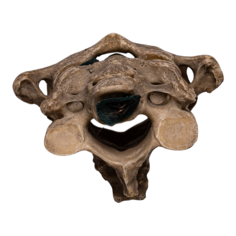 Real Human Vertebrae Set
