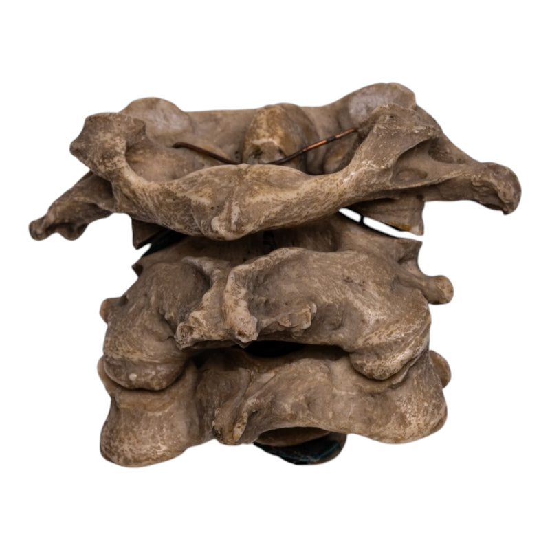 Real Human Vertebrae Set