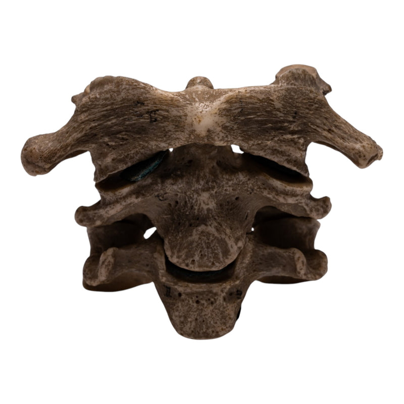 Real Human Vertebrae Set