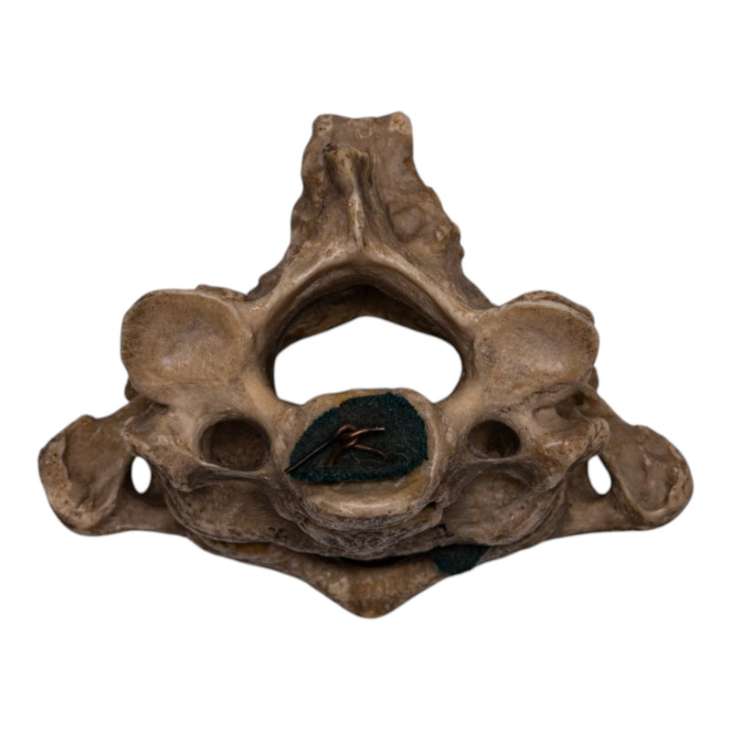 Real Human Vertebrae Set