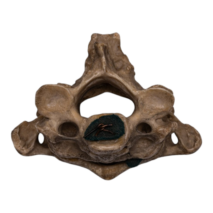 Real Human Vertebrae Set