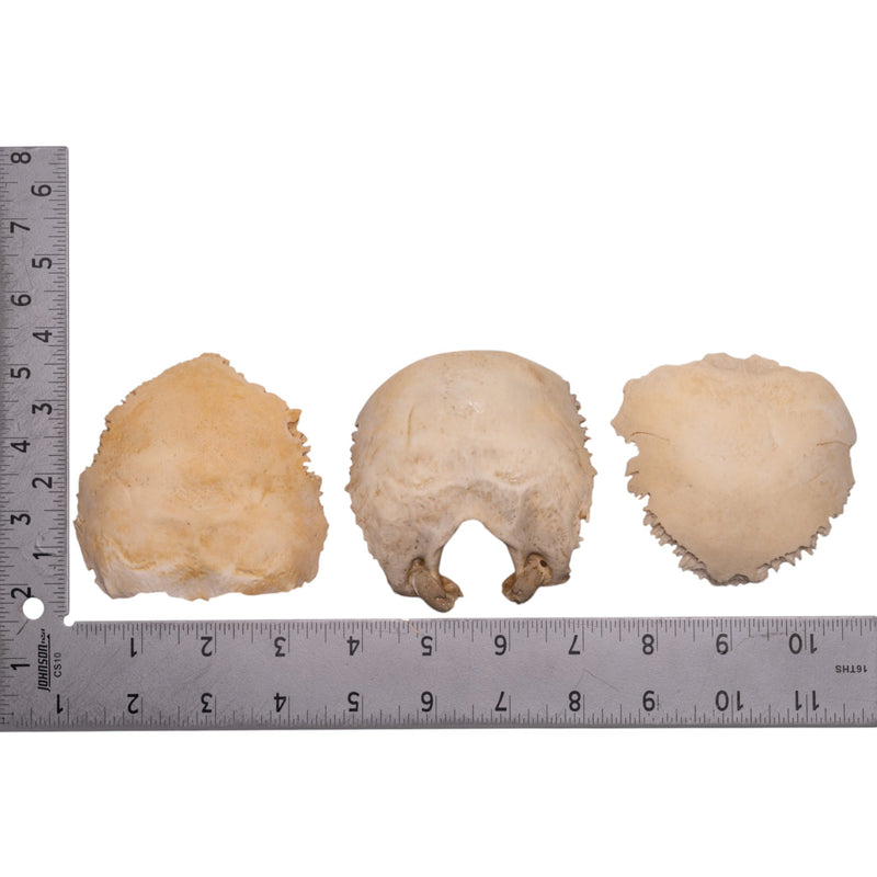 Real Human Child Occipital Bone