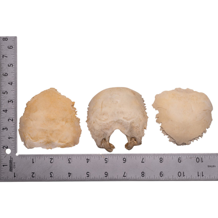 Real Human Child Occipital Bone