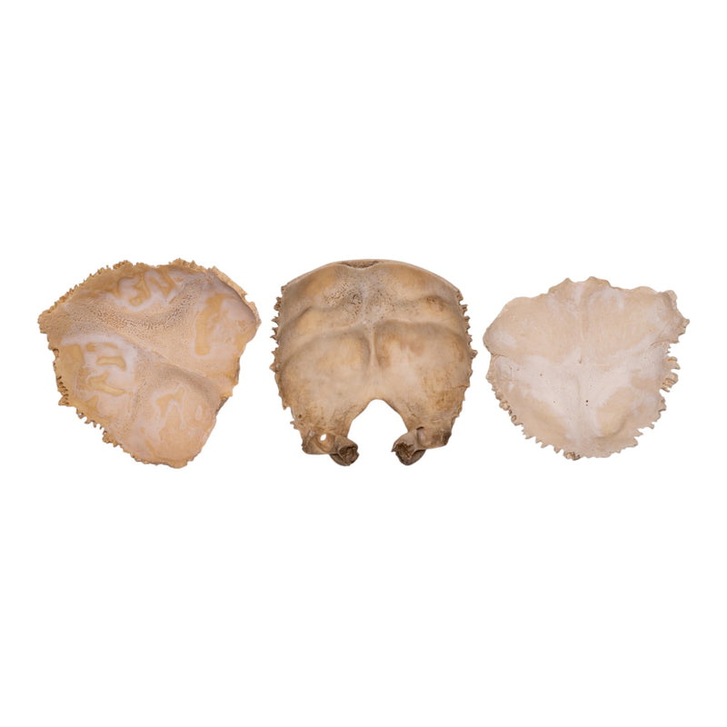 Real Human Child Occipital Bone
