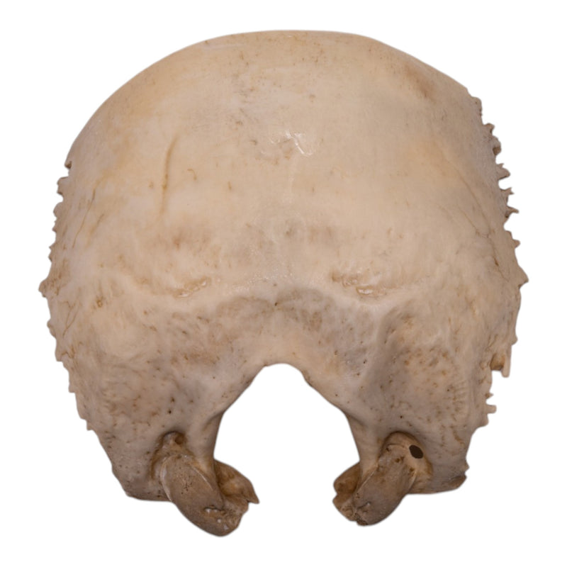 Real Human Child Occipital Bone