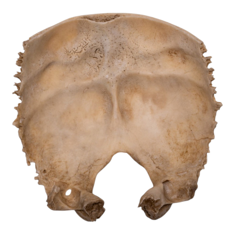 Real Human Child Occipital Bone
