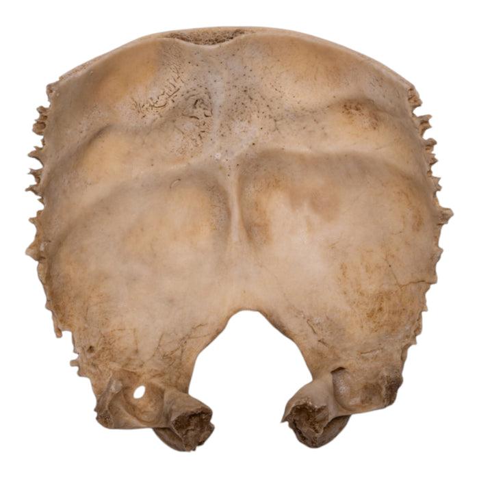 Real Human Child Occipital Bone