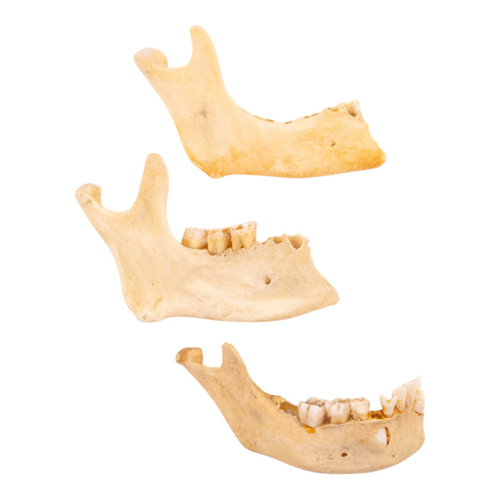 Real Human Partial Mandible - Set of 3