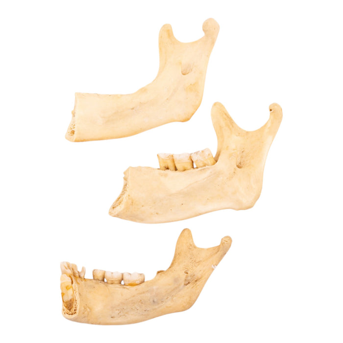 Real Human Partial Mandible - Set of 3