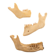 Real Human Partial Mandible - Set of 3