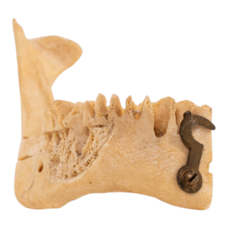 Real Human Partial Mandible - Set of 3