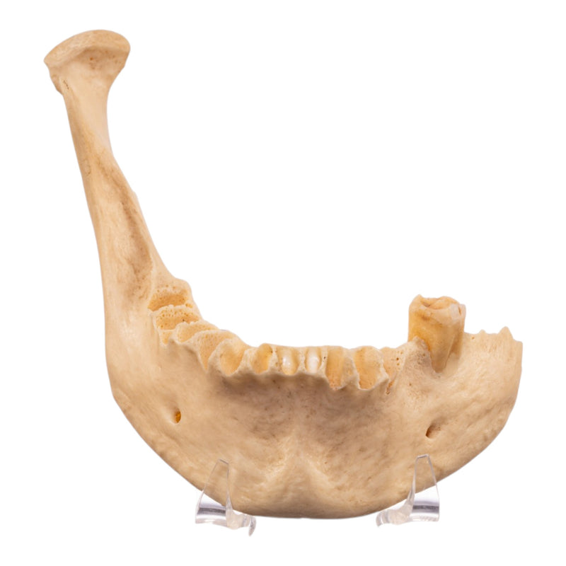 Real Human Mandible - Set of 3