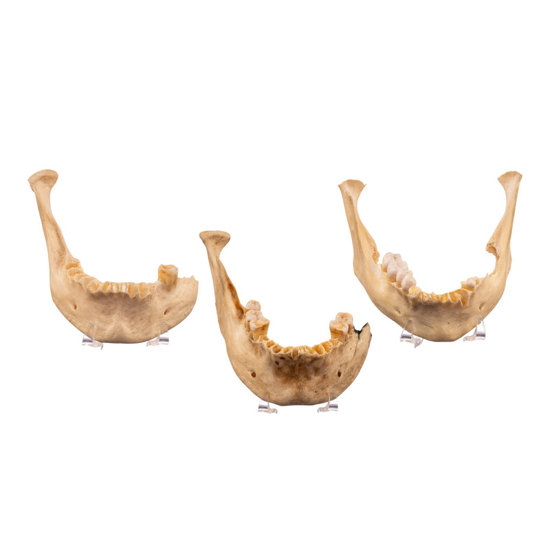 Real Human Mandible - Set of 3