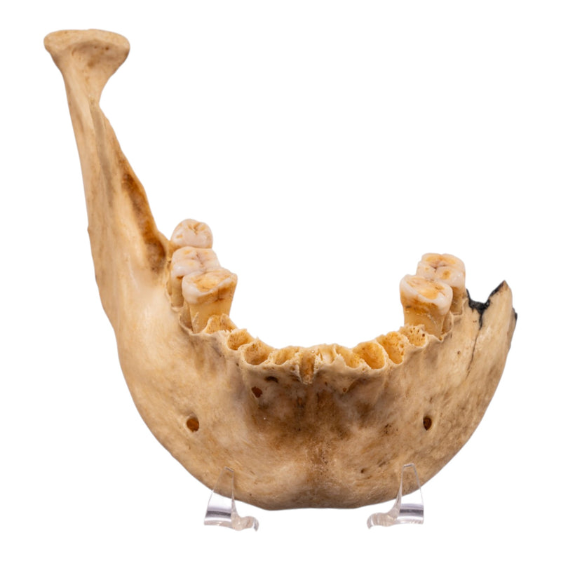 Real Human Mandible - Set of 3