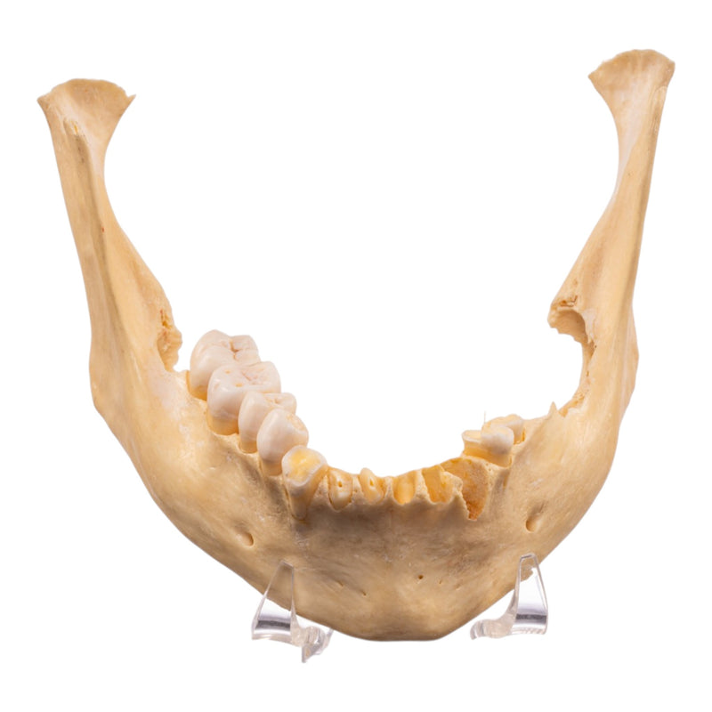 Real Human Mandible - Set of 3