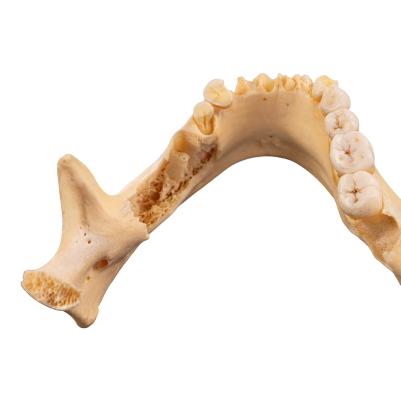 Real Human Mandible - Set of 3