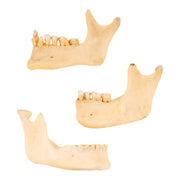 Real Human Partial Mandible - Set of 3