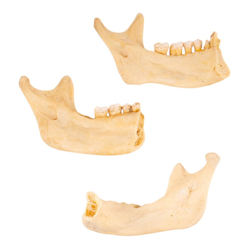 Real Human Partial Mandible - Set of 3