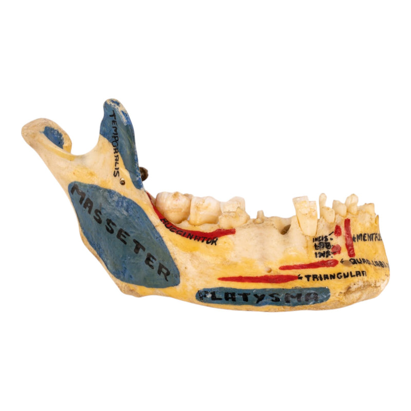 Real Human Partial Mandible - Painted