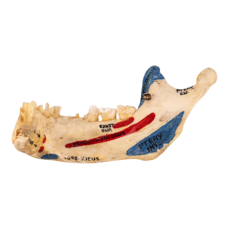 Real Human Partial Mandible - Painted