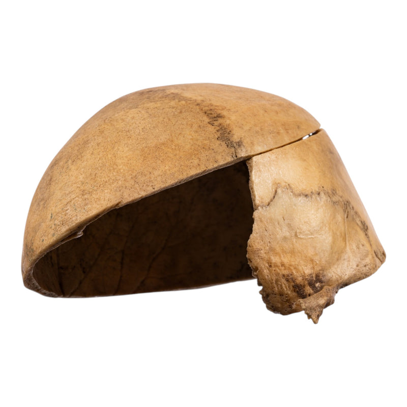 Real Human Calvaria