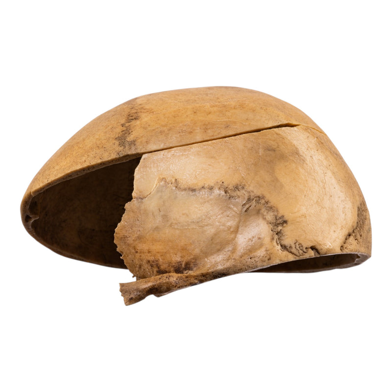 Real Human Calvaria
