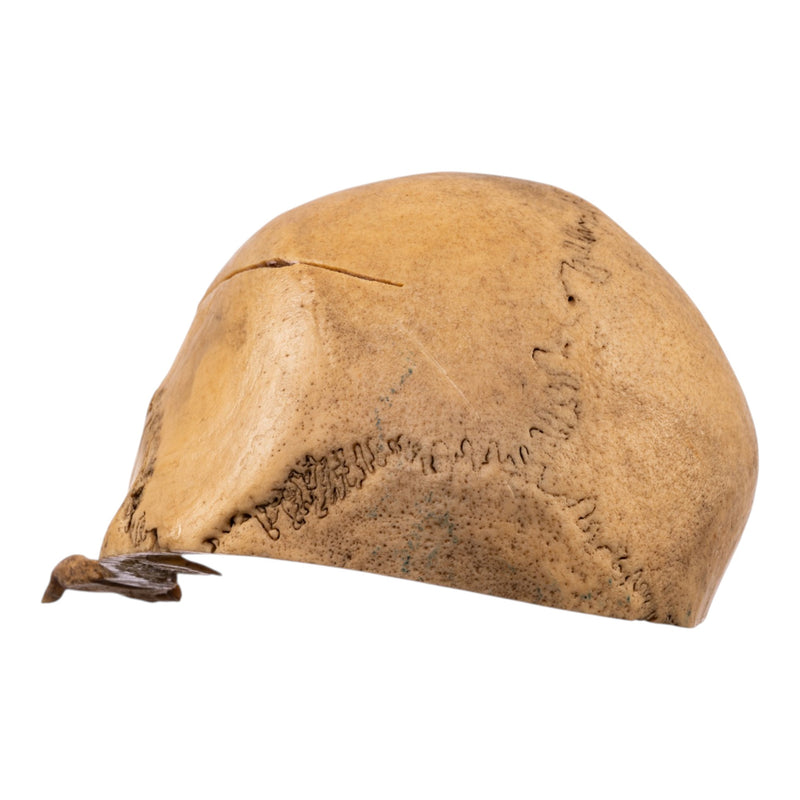 Real Human Calvaria