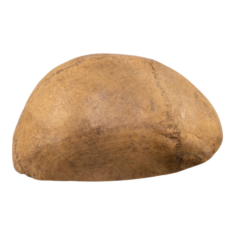 Real Human Calvaria