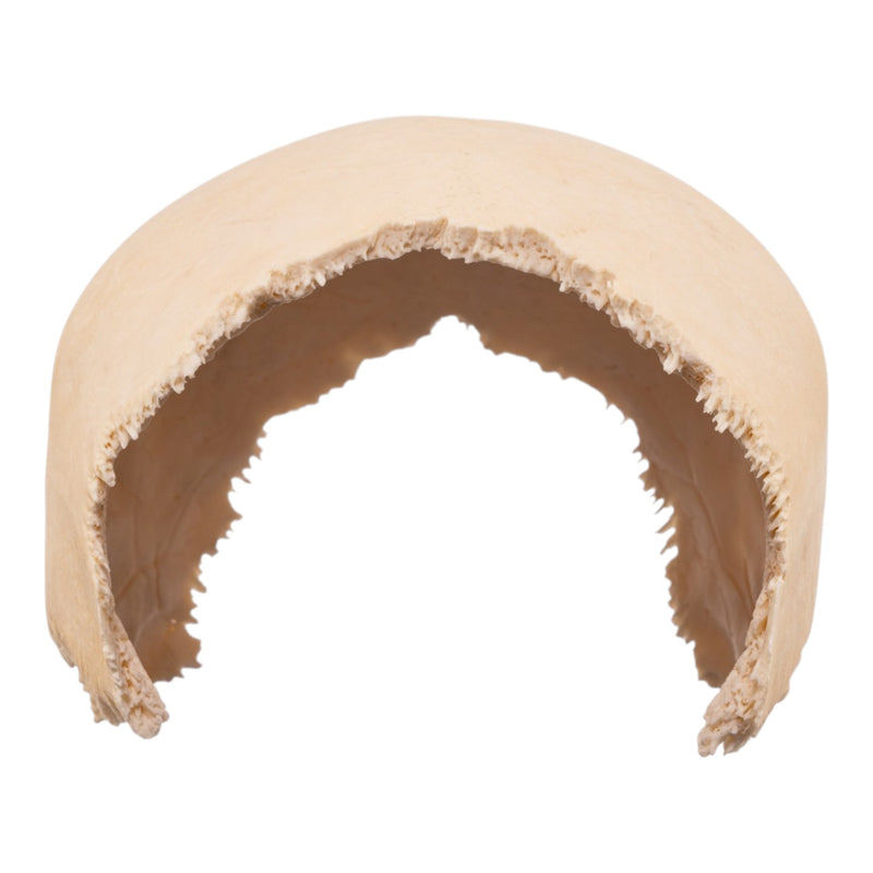 Real Human Fused Parietal Halves