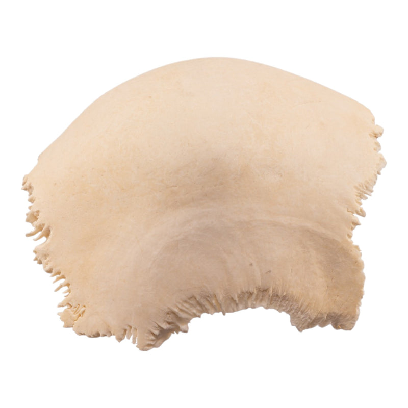 Real Human Fused Parietal Halves