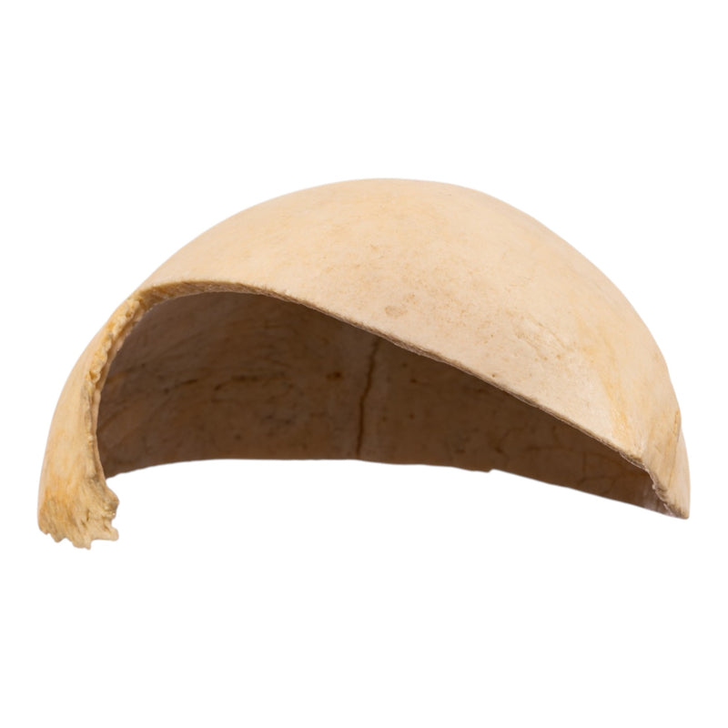 Real Human Partial Calvaria