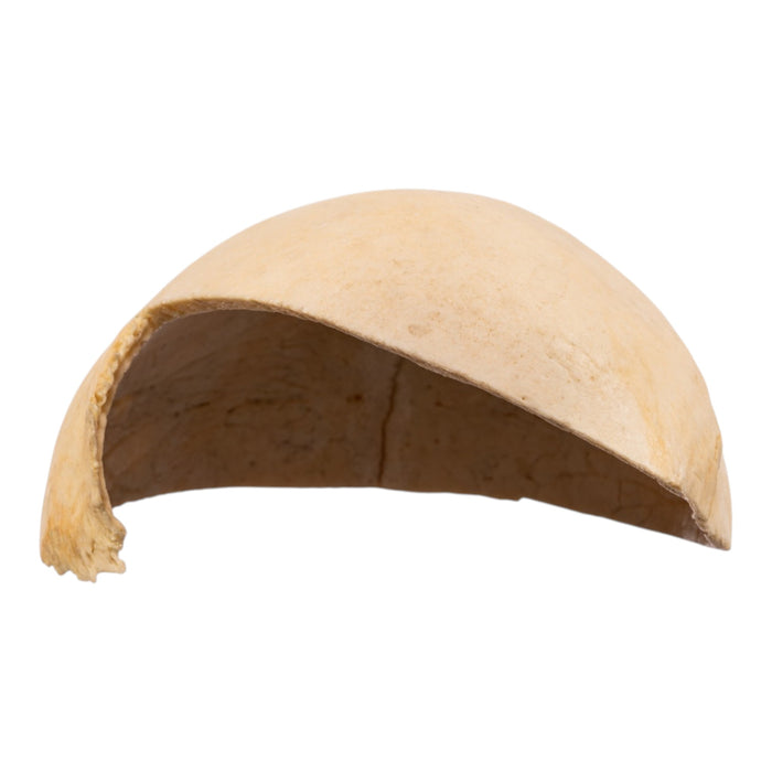 Real Human Partial Calvaria
