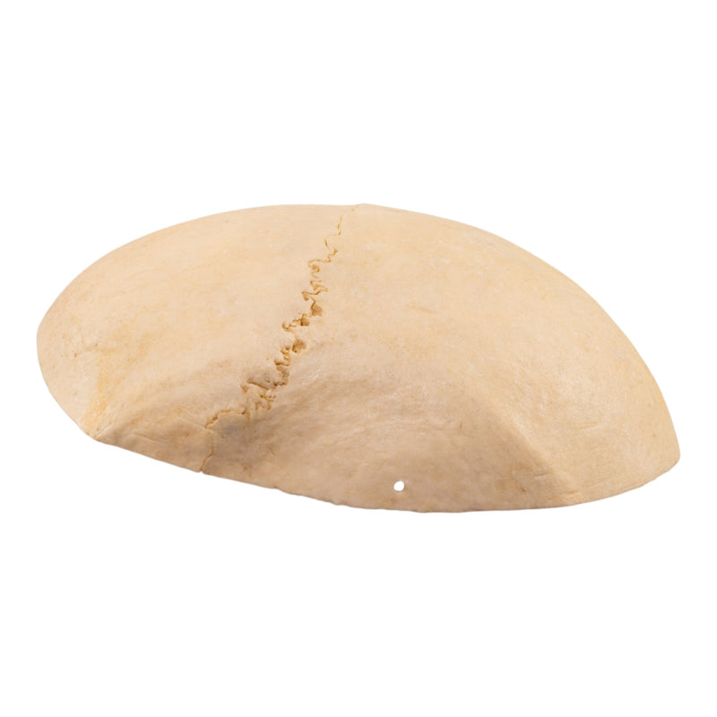 Real Human Partial Calvaria