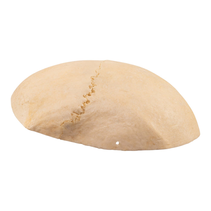 Real Human Partial Calvaria