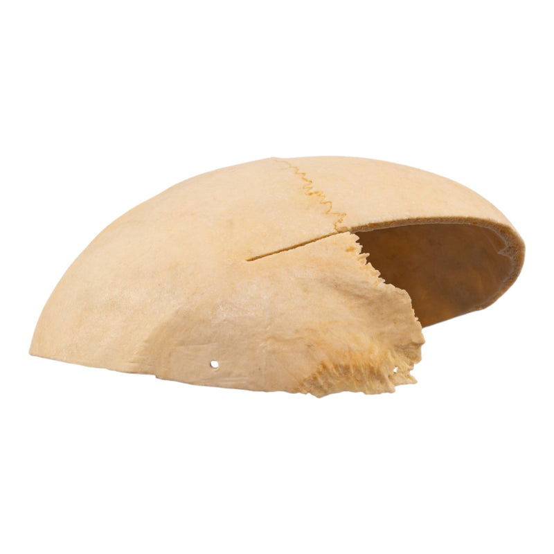 Real Human Partial Calvaria