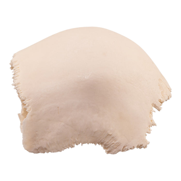 Real Human Skull Cap – Parietal Bones