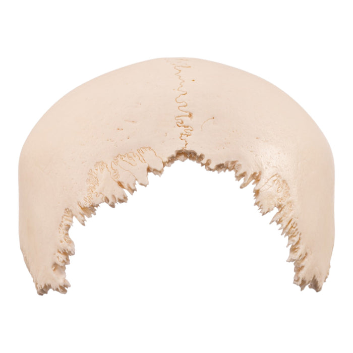 Real Human Skull Cap – Parietal Bones