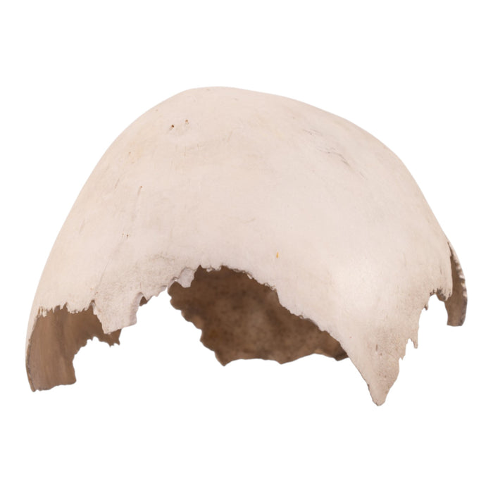 Real Human Child Partial Skull