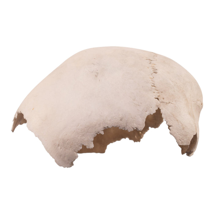 Real Human Child Partial Skull