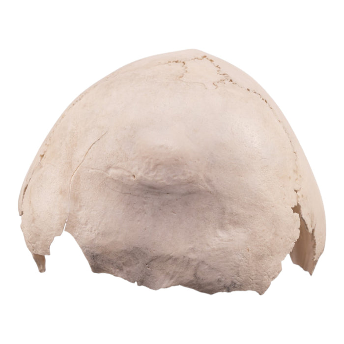 Real Human Child Partial Skull