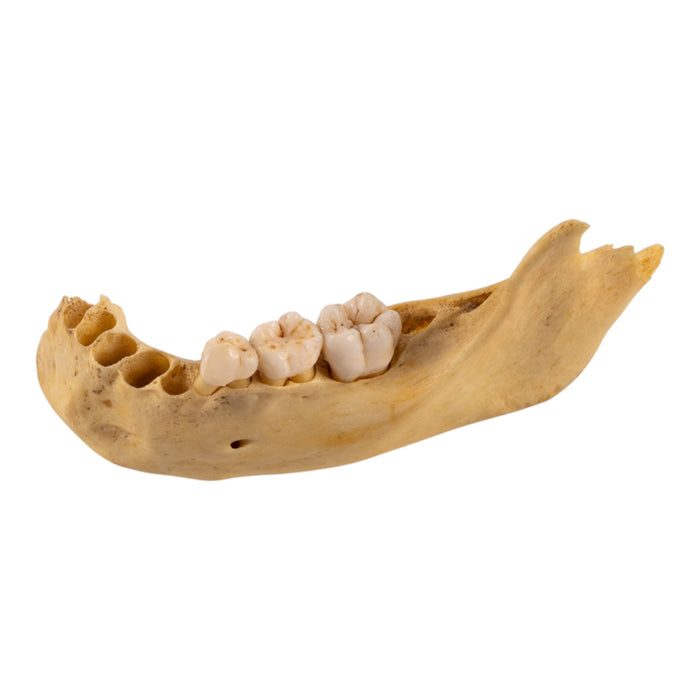 Real Human Child Partial Mandible