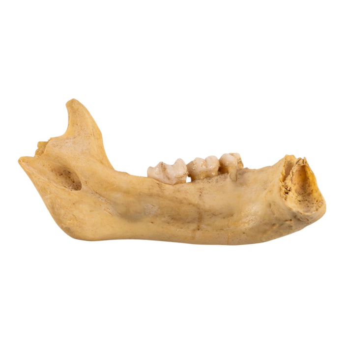 Real Human Child Partial Mandible