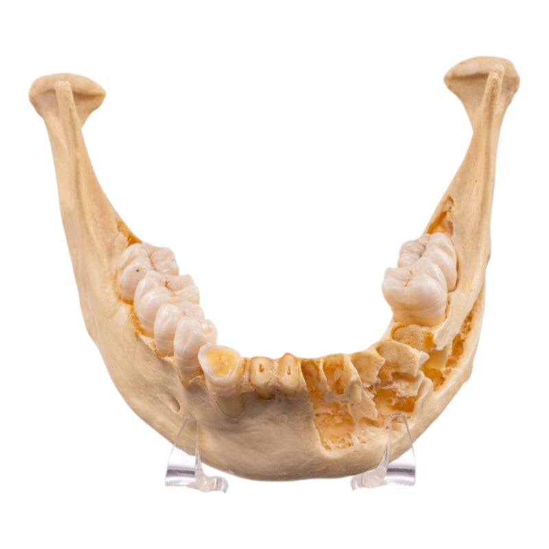 Real Human Mandible