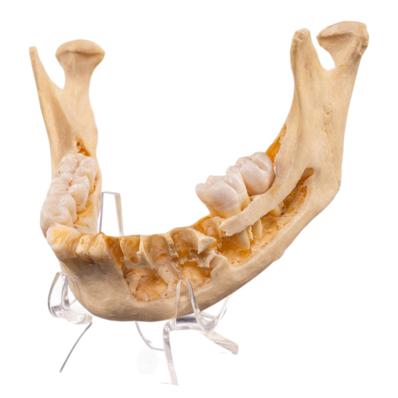 Real Human Mandible