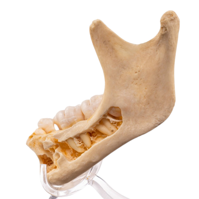 Real Human Mandible
